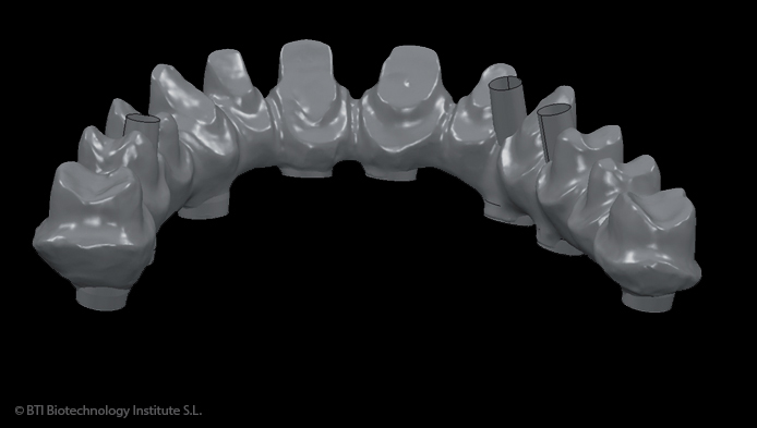 #slide4 diseno-cad-cam