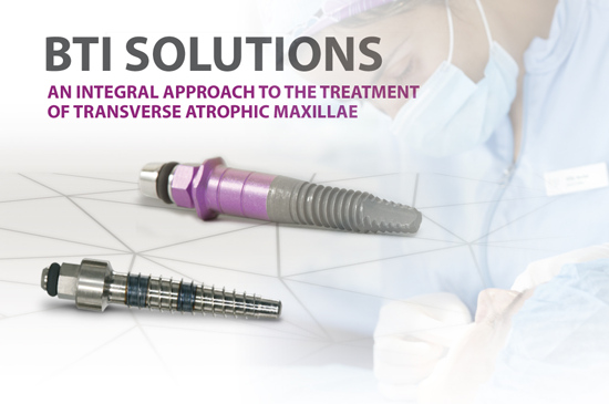 #slide2