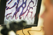 Investigación I+D+i PRGF®-Endoret®