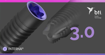 Das neue 3.0 Implant