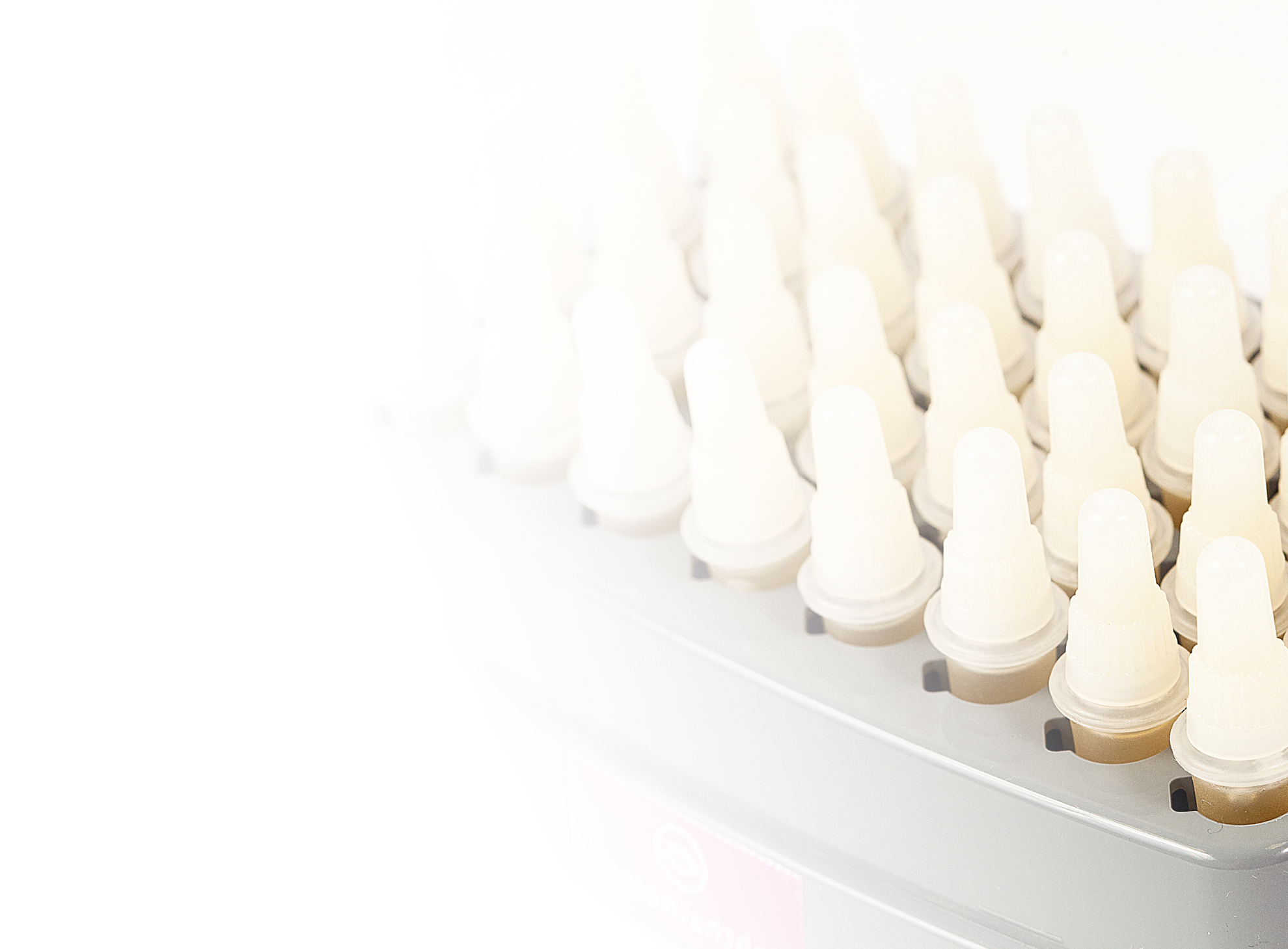 Efficacy of Plasma Rich in Growth Factors for the Treatment of Dry Eye