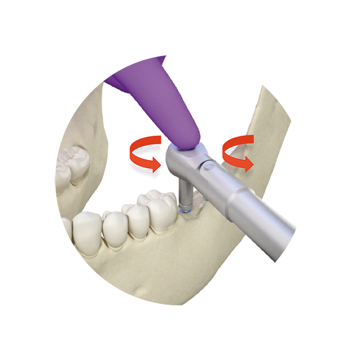 llave contratorque kit extracción implantes